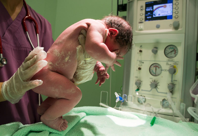 Влияе ли цезаровото сечение на новородените